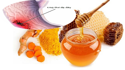 Điều trị ung thư dạ dày bằng mật ong và nghệ 